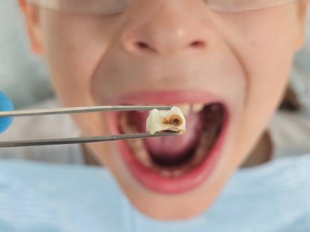 Best Broken Tooth Emergency  in Etowah, NC